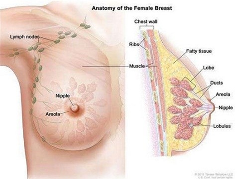 Sự hình thành khối u tại ngực ở phụ nữ