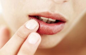 Thói quen xấu làm môi khô nẻ nhiều chị em thường mắc phải
