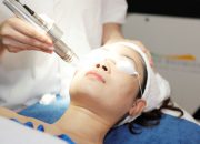 3 Sai lầm khiến cho việc điều trị nám da bằng laser không hiệu quả