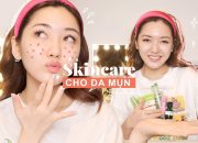 Skincare 5 bước đơn giản cho da dầu mụn 🌟 | Chloe Nguyen