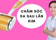 Chăm sóc da sau lăn kim chuẩn y khoa-không phải ai cũng biết/lưu ý sau lăn kim/Hải Yến nursing