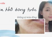 Cấp cứu da khô tróc vảy, nứt nẻ mùa đông chỉ trong 3 ngày