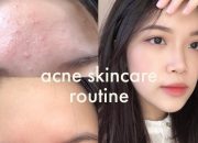 Skincare Routine | MÌNH ĐÃ TRỊ MỤN ẨN NHƯ THẾ NÀO? | HOW TO TREAT COMEDONE ACNE? | Coanh Coanh