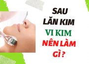 Sau lăn kim | Sau Lăn kim vi kim Nên làm gì ? Ngày#2